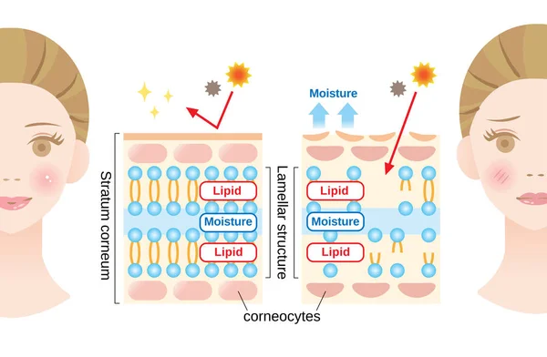 健康的皮肤和干燥的皮肤图与妇女的脸 角质层和层状结构的结构 对皮肤屏障功能起着保护作用 美容和护肤理念 — 图库矢量图片