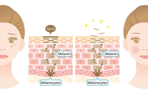 Mekanismen För Hud Cellernas Omsättning Illustration Melanin Och Melanocyter Mänskligt — Stock vektor