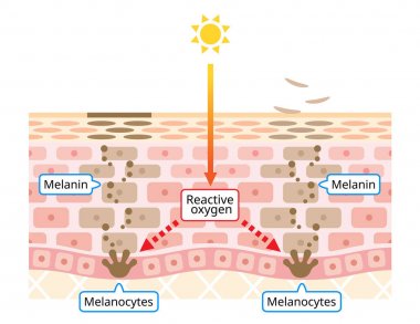 mechanism of skin cell turnover and facial dark spots. Melanin and melanocytes in human skin layer. beauty and skin care concept clipart