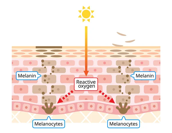 Mecanismo Recambio Celular Piel Manchas Oscuras Faciales Melanina Melanocitos Capa — Vector de stock