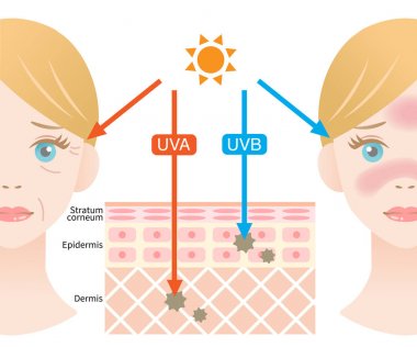 infographic illustration of difference between UVA and UVB rays.  UV penetration into human skin and white woman face. skin care and beauty concept clipart