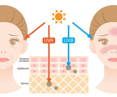 infographic illustration of difference between UVA and UVB rays. UV penetration into human skin and woman face. skin care and beauty concept clipart