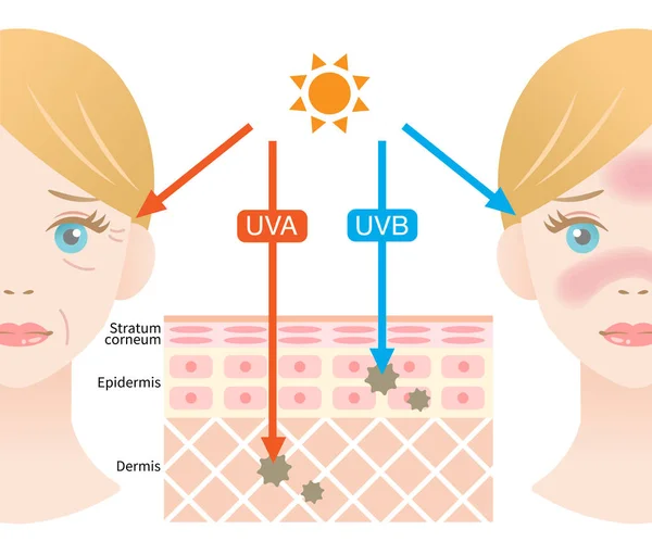 Infographic Illustratie Van Verschil Tussen Uva Uvb Stralen Penetratie Menselijke — Stockvector