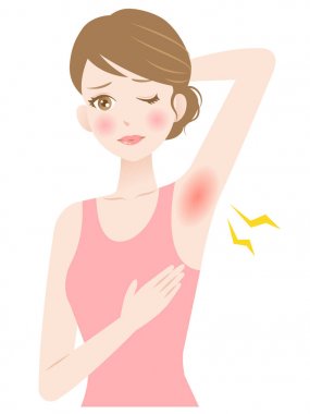 womans armpit hair removal. underarm r rash. beauty and healthy skin care concept