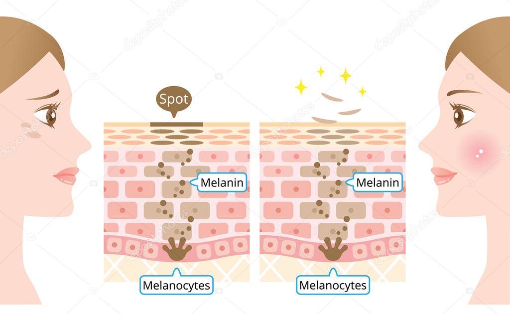 mechanism of skin cell turnover illustration. Melanin and melanocytes in human skin layer with woman face. beauty and skin care concept