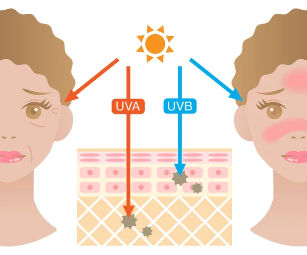 Απεικονιστική Στρώση Του Δέρματος Διαφορά Μεταξύ Uva Και Uvb Ακτίνες — Διανυσματικό Αρχείο