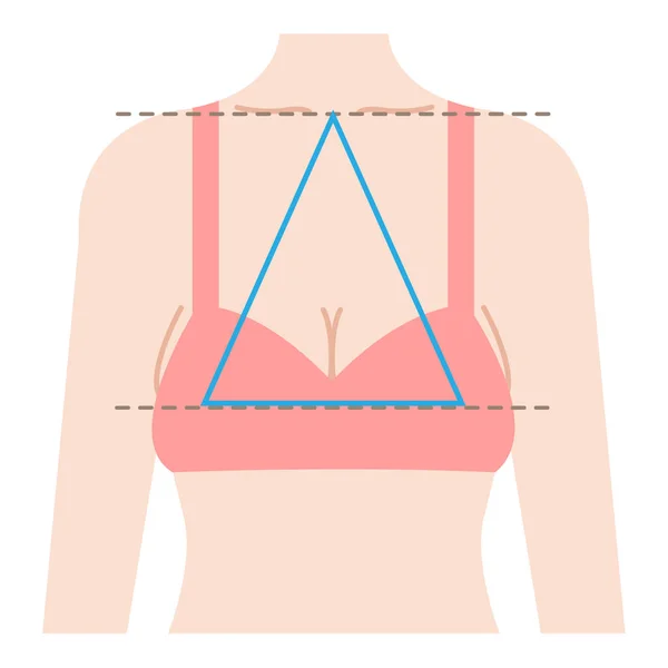 Провисающая Форма Груди Равнобедренный Треугольник Соединяющий Три Точки Центра Ключицы — стоковый вектор