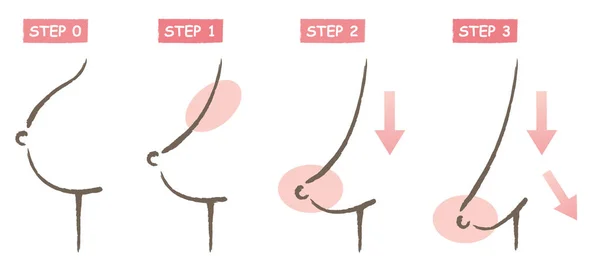 年轻和年老的胸部改变插图在四个步骤 胸部失去它的坚定性 开始下降在老化过程中 在白色背景上隔离 — 图库矢量图片