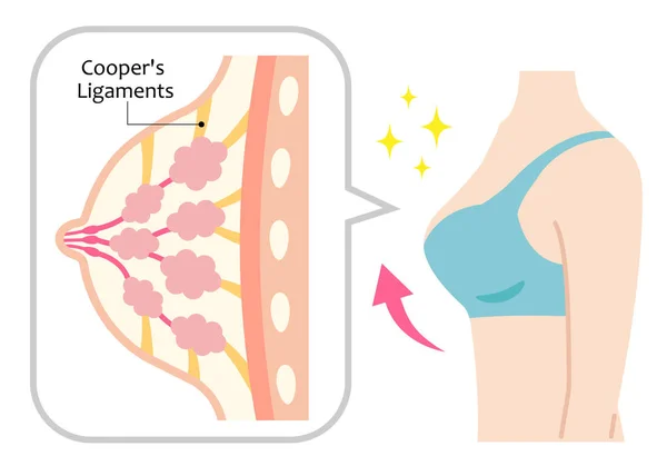 Struttura Del Seno Sodo Corpo Delle Donne Legamenti Cooper Forma — Vettoriale Stock