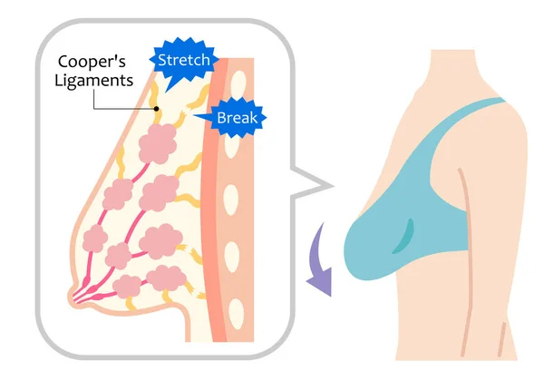 Diagramma Seni Cadenti Illustrazione Del Corpo Delle Donne Corpo Bellezza — Vettoriale Stock