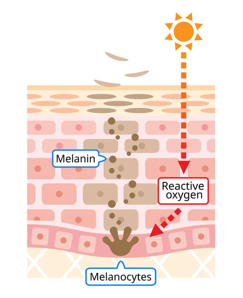 Mechanismus Obratu Kožní Buňky Melanin Melanocyty Lidskou Vrstvou Kůže Koncepce — Stockový vektor