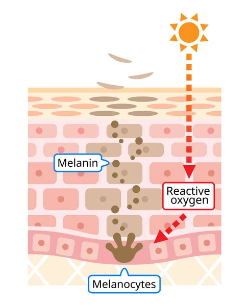 Mechanisme Van Huid Celomzet Illustratie Melanin Melanocyten Met Humane Huidlaag — Stockvector