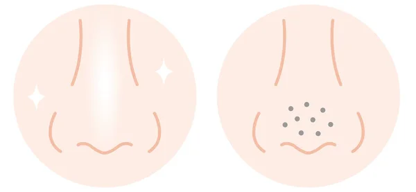 Poros Piel Nariz Humana Antes Después Ilustración Normal Blackhead Concepto — Vector de stock