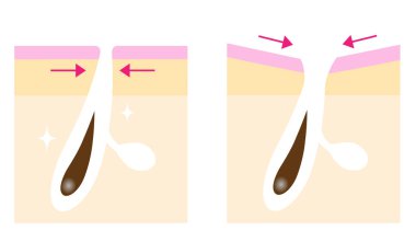 Çizimlerden önce sarkan cilt gözenekleri. Yüz ve vücut bakımı kavramı.