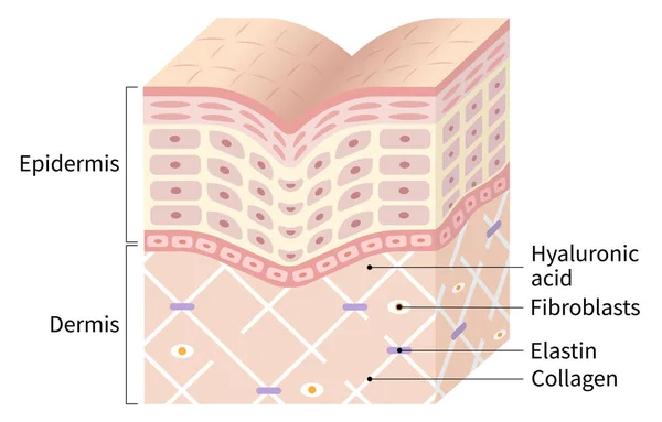 Diagrama Piel Cabrestante Marco Colágeno Está Roto Aparecen Arrugas Belleza — Vector de stock