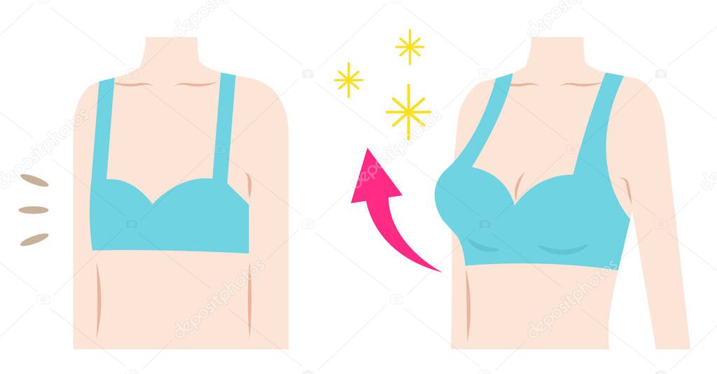 breast augmentation before after illustration. body care and beauty concept. Isolated on white background
