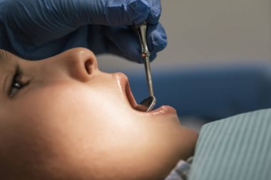 Diş müdahalesi sırasında diş hekiminin yakın çekimi