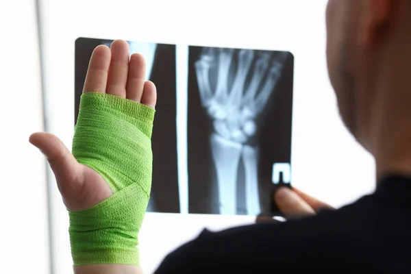 Mann mit verletztem Arm — Stockfoto