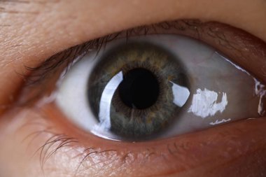 Erkek, gri, yeşil, sağ göz.