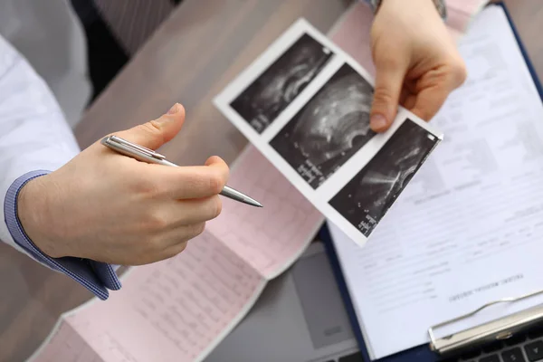 Lekarz porównuje kardiogram, USG diagnozy. — Zdjęcie stockowe