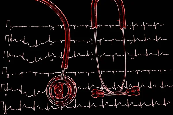 Stetoscopio Sul Grafico Dell Elettrocardiogramma Ecg Vista Dall Alto — Foto Stock