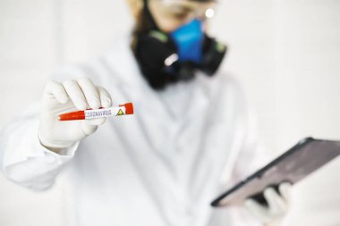 Laboratuvardaki bir bilim adamı viral zatürreenin tedavisi için ilaçları test ediyor. Hastalıklı hastaların Coronovirus kan testi. Dünya salgını.