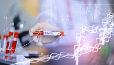 Laboratuvardaki bir bilim adamı viral zatürreenin tedavisi için ilaçları test ediyor. Hastalıklı hastaların Coronovirus kan testi. Dünya salgını.