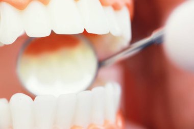 Dişçinin ofisi. Dişçi ağız boşluğu tedavisini inceliyor. Doktor bir tedavi yöntemi gösteriyor. Tedavi görüyor. Kaplamaların yerleştirilmesi ve yerleştirilmesi.