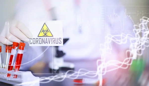 A scientist researcher in the laboratory is testing drugs for treatment of viral pneumonia. Coronovirus blood test of infected patients. World pandemic.