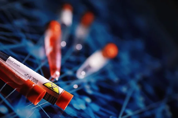 Test Tüpü Hasta Kan Testi Virüs Analizi Coronavirus Salgını Laboratuvar — Stok fotoğraf