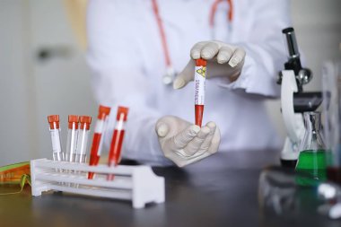 Laboratuvardaki bir bilim adamı viral zatürreenin tedavisi için ilaçları test ediyor. Hastalıklı hastaların Coronovirus kan testi. Dünya salgını.