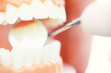 Dişçinin ofisi. Dişçi ağız boşluğu tedavisini inceliyor. Doktor bir tedavi yöntemi gösteriyor. Tedavi görüyor. Kaplamaların yerleştirilmesi ve yerleştirilmesi.