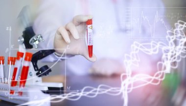 Laboratuvardaki bir bilim adamı viral zatürreenin tedavisi için ilaçları test ediyor. Hastalıklı hastaların Coronovirus kan testi. Dünya salgını.