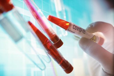 Test tüpü ve hasta kan testi. Virüs analizi. Coronavirus salgını laboratuvar çalışmaları. Aşı geliştirme.