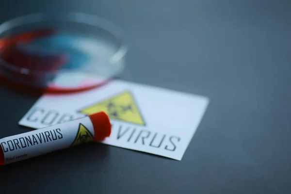 A blood sample for testing the dangerous virus coronavirus in body. Test tubes with tests for coronavirus. Laboratory studies of viral diseases.