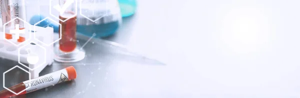 Blood Sample Testing Dangerous Virus Coronavirus Body Test Tubes Tests — Stock Photo, Image