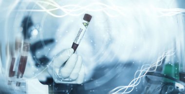 Laboratuvardaki bir bilim adamı viral zatürreenin tedavisi için ilaçları test ediyor. Hastalıklı hastaların Coronovirus kan testi. Dünya salgını.