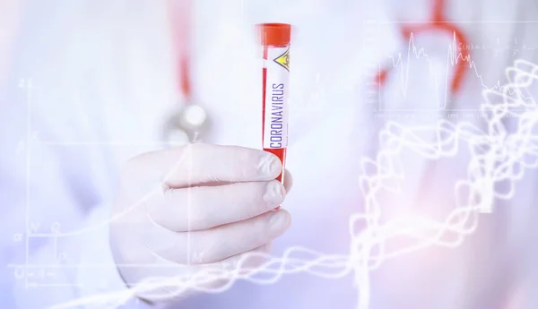 A scientist researcher in the laboratory is testing drugs for treatment of viral pneumonia. Coronovirus blood test of infected patients. World pandemic.