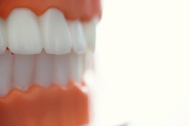 Dişçinin ofisi. Dişçi ağız boşluğu tedavisini inceliyor. Doktor bir tedavi yöntemi gösteriyor. Tedavi görüyor. Kaplamaların yerleştirilmesi ve yerleştirilmesi.