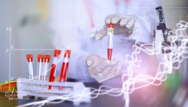 Laboratuvardaki bir bilim adamı viral zatürreenin tedavisi için ilaçları test ediyor. Hastalıklı hastaların Coronovirus kan testi. Dünya salgını.