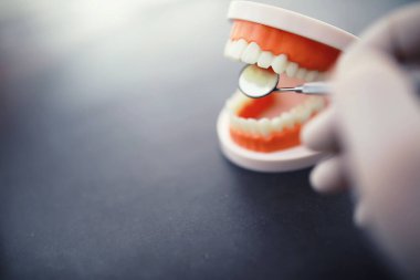 Dişçinin ofisi. Dişçi ağız boşluğu tedavisini inceliyor. Doktor bir tedavi yöntemi gösteriyor. Tedavi görüyor. Kaplamaların yerleştirilmesi ve yerleştirilmesi.