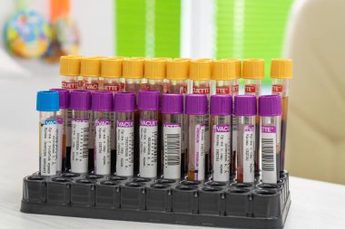 Doktor hastayı kan örneğine hazırlıyor. Masadaki kan testi araçlarına odaklan