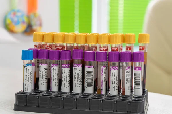 Doktor hastayı kan örneğine hazırlıyor. Masadaki kan testi araçlarına odaklan