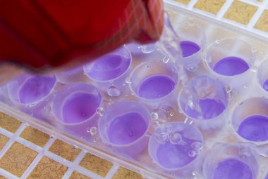 Su filtresinden bir buz kalıp içine dökülür