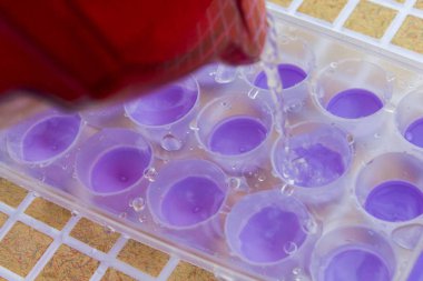 Su filtresinden bir buz kalıp içine dökülür