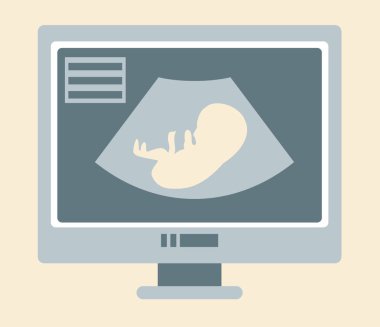 Gebelik ultrason tarama izometrik tasarım vektör illüstrasyon. Ultrason tarayıcı ekranında Embriyo