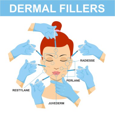 Dermal dolgu enjeksiyonu ile ayarlayın. Yüz cilt için tıbbi kozmetik prosedürleri ile Infographics. Güzellik, kozmetoloji, yaşlanma karşıtı kavram. güzel kadın hyaluronik asit dolgu enjeksiyon sahip