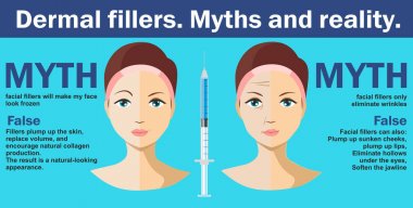 Dermal Dolgu enjeksiyonları-Infographics. vektör Illustration kadın hyaluronik asit yüz enjeksiyon sahip. Vector Infographics tasarım şablonu. Güzellik, kozmetoloji, yaşlanma karşıtı konsept