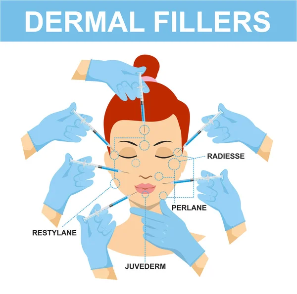 Zestaw Wypełniaczami Skórnych Zastrzyki Infografiki Medycznych Zabiegów Kosmetycznych Dla Skóry — Wektor stockowy