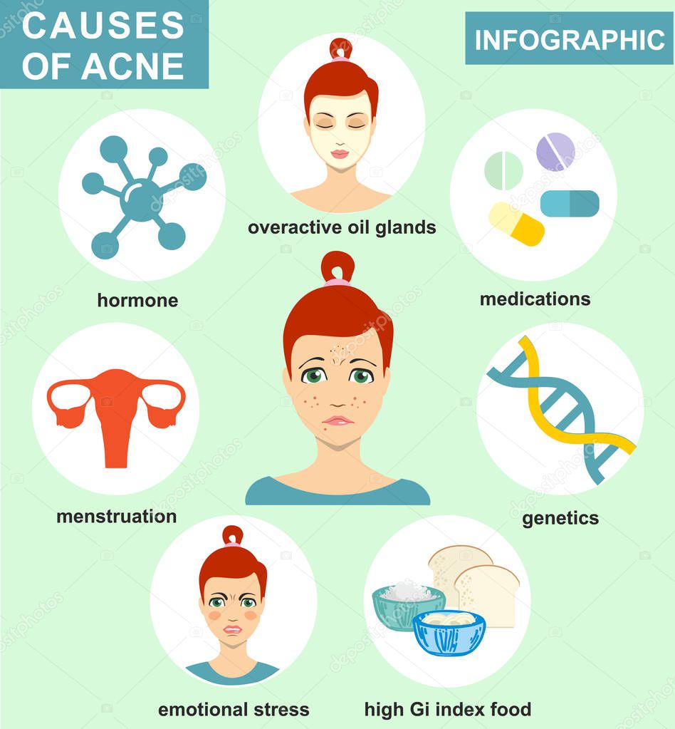 Causes of acne. Skin problems and diseases beauty infographics. Vector illustration. Dermatology, skin care infographic 